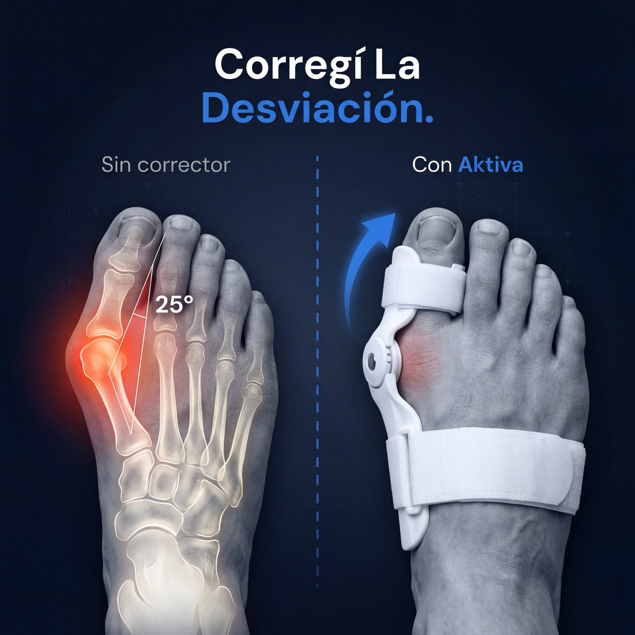 Corrector de Juanetes | Aktiva Uruguay