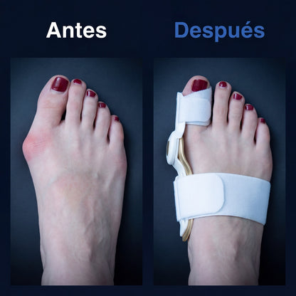 Corrector de Juanetes | Aktiva Uruguay